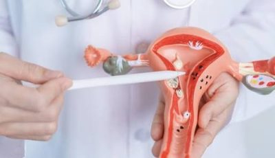 cancer de cuello uterini