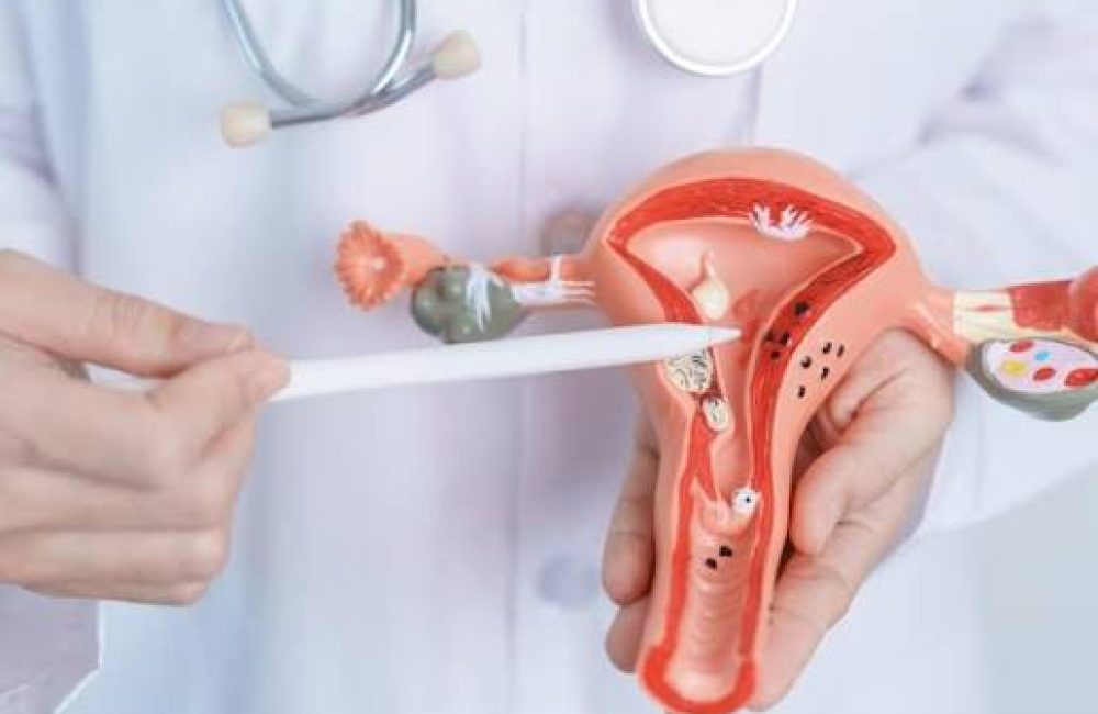 cancer de cuello uterini